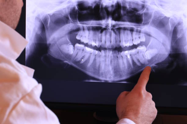 Best Knocked-Out Tooth Emergency  in Midlothian, VA